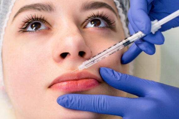 DermalFiller1 f