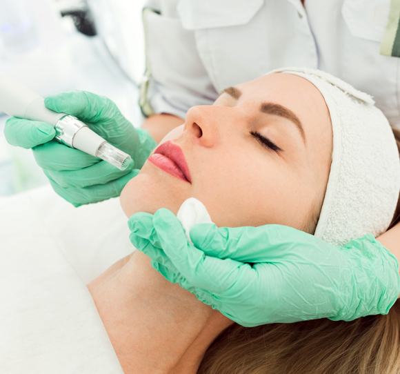 Microneedling